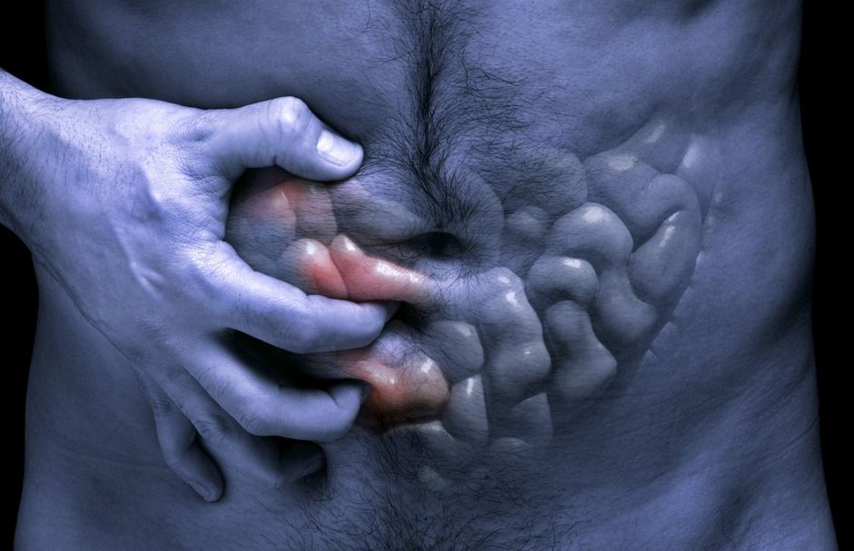Bevestiging van de link tussen de ziekte van Crohn en spondyloartritis