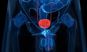 Een nieuw model voor opsporing van prostaatkanker