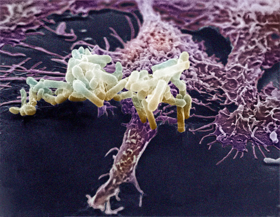 Microbioom als merker voor prognose bij mucoviscidose