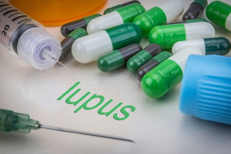 Correlatie tussen systemische lupus erythematosus en kankerrisico