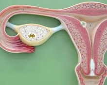 Het gebruik van aspirine en NSAID's verlaagt het risico op ovariumkanker