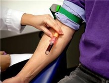 Resistentie tegen enzalutamide voorspellen met bloedonderzoek?