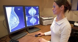 Fout-positieve uitkomsten bij screening op borstkanker
