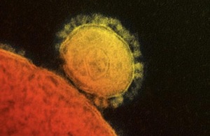 Nieuwe aanbeveling voor aanpak MERS-Coronavirus