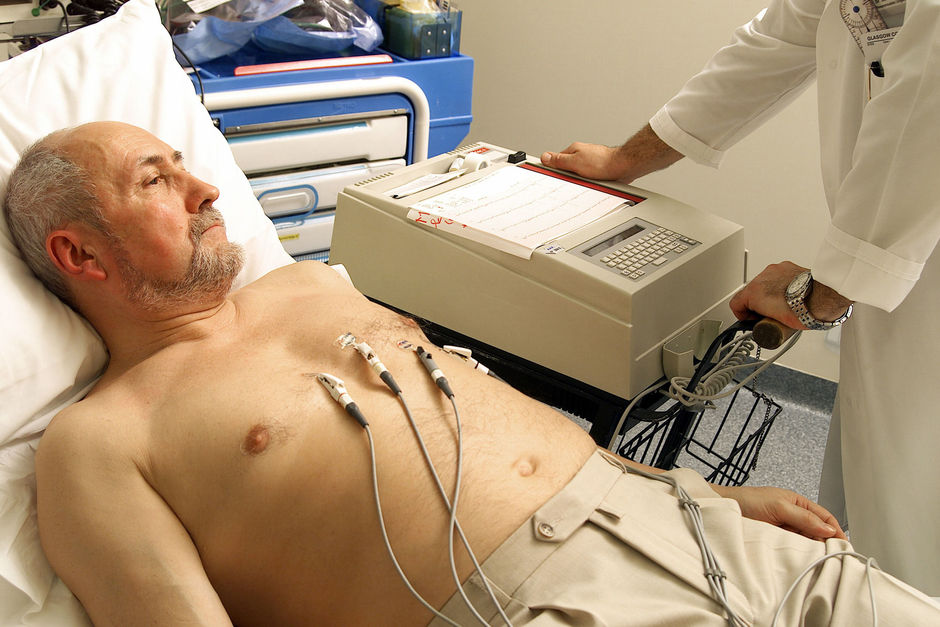 Hartfalen na eerste hartinfarct correleert met hoger kankerrisico